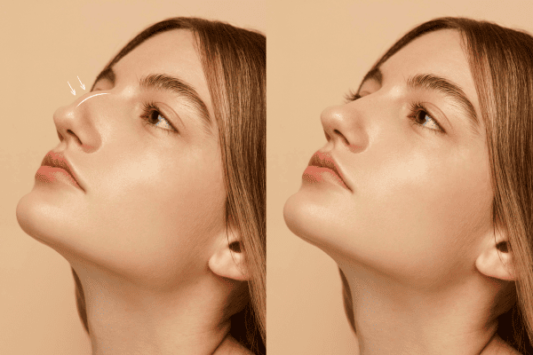 Como é feito procedimento facial - Dra Vviane Masoller